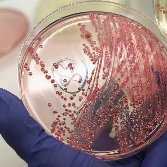 Fungus Culture Any Specimen